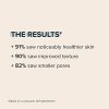 Paulas Choice--SKIN PERFECTING 2% BHA Liquid Salicylic Acid Exfoliant