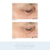 NuFACE Anniversary Complete Facial Toning Kit | Trinity Facial Device