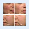 First Aid Beauty Ultra Repair Cream Intense Hydration Moisturizer