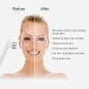 Professional RF Skin Tightening Machine – Anti-Aging Facial & Body Lifting Device – MLAY