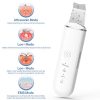 Revolutionary Ultrasonic Skin Scrubber – Deep Cleansing, Blackhead Removal, Face Lifting Tool