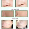 Revive Dead Sea Mud Mask for Pores, Acne & Blackheads – Best Natural Facial Cleanser