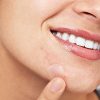 Mighty Patch Micropoint for Blemishes - Hydrocolloid Acne Spot Treatment