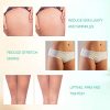 Professional RF Skin Tightening Machine – Anti-Aging Facial & Body Lifting Device – MLAY