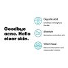Proactiv Hydrating Facial Toner For Sensitive Skin