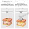 Professional RF Skin Tightening Machine – Anti-Aging Facial & Body Lifting Device – MLAY