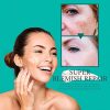 Yebobo Skin Care Enhanced Renewal Cream Spot Corrector Remover
