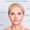 Blumbody Wrinkle Patches for Face - 160 Triangle Wrinkle Remover Strips