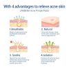 Reddhoon Acne Pimple Patch, Acne Treatment Pimple Patches