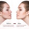 Portable Facial Machine for Skin Tightening, Acne, and Wrinkle Removal