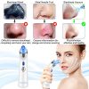 GlowMaster Blackhead Eraser - Your Path to Flawless Skin