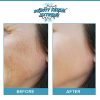 Anti Aging Resurfacing Chemical Peel Pads- Contains Lactic Acid
