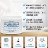 Ebanel Bundle of 40% Urea Cream 4.6 Oz, and Exfoliating Face Scrub