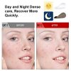 ALDOM Acne Pimple Patches, Hydrocolloid Acne Patch Treatment