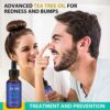 Tea Tree Oil Clear Skin Face Serum Acne Treatment Promote Collagen