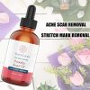Rosehip Oil Organic Cold Pressed Moisturizer For Face Hair Skin Nails