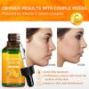 Vitamin C Serum, Vitamin C Serum for Face with Hyaluronic Acid