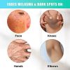 RadiantSkin Dark Spot Corrector Serum: Your Path to Flawless Skin