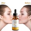 dermaXgen Pure Vitamin C 20%+ E + Hyaluronic Acid Face Serum