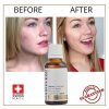 Luxury Dark spot remover for Face and Body Serum