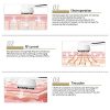 Facial Massager, Skin Tightening Machine,Electric Face Massager for Women