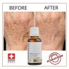 Luxury Dark spot remover for Face and Body Serum