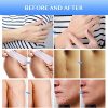 Scar Removal Gel For New and Old Scars, Skin Repair Gel for Face, Body
