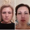 Luxury Dark spot remover for Face and Body Serum
