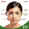 Face Mask Lab - Face Mask [20 Pack Set] Hydrating Facial Skin Care