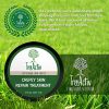 TreeActiv Crepey Skin Repair Treatment, Extra Strength Anti Aging Face Cream