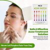 Acne Patches for Face - Hydrocolloid Bandages (540 Count) Pimple Patch