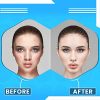 144 Count Acne Pimple Patches, Absorbing Hydrocolloid Spot Treatment