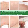Acne Pimple Healing Patch - Absorbing Hydrocolloid Blemish Spot Skin Treatment