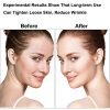 Sonic Face Massager, Skin Tightening Machine Eye Neck Face Lift