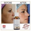 Luxury Dark spot remover for Face and Body Serum