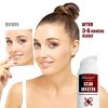 Ebanel Advanced Silicone Scar Gel, Scar Removal Cream for Old & New Scars