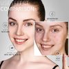 Acne Pimple Healing Patch - Absorbing Hydrocolloid Blemish Spot Skin Treatment