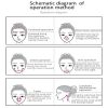 Face Massager Anti Wrinkles 6℃ ± 42℃ Hot and Cold Facial Massager