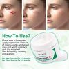 Scar Removal Cream, Advanced Acne Marks Treatment, Face and Body Skin