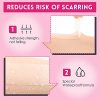 Acne Pimple Master Patch, Large Acne Patches Spot Treatment