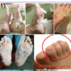 Foot mask exfoliating Peeling
