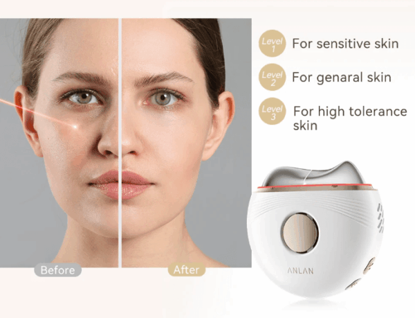 EMS Electric Gua Sha Massager with 3-Color Phototherapy3 EMS Electric Gua Sha Massager with 3-Color Phototherapy – Perfect for Face, Neck & Body Lifting