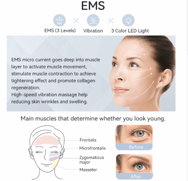EMS Facial Massager with Hot & Cold Compress2 EMS Facial Massager with Hot & Cold Compress – At-Home Skin Tightening & Anti-Aging Beauty Device